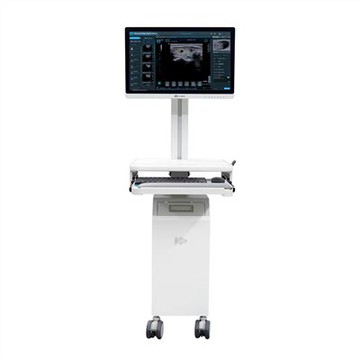 אבחון אולטרסאונד אינטליגנטי